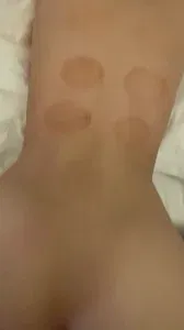 后入极品身材小母狗，刚拔完火罐没两天就被爆操